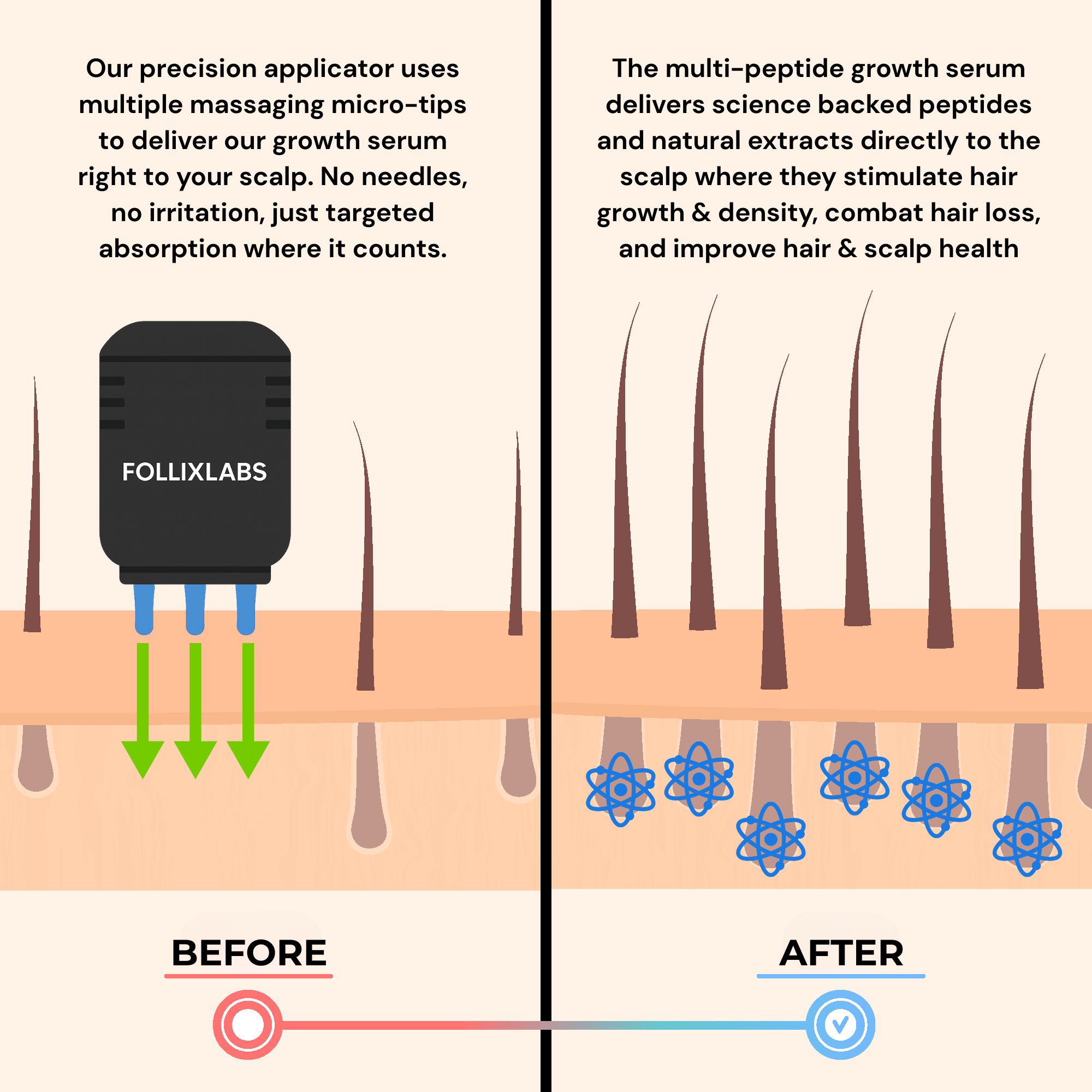 Follix Hair Growth Solution & Precision Applicator Bundle