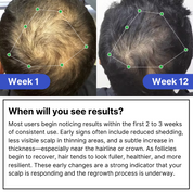 Follix Hair Growth Solution & Precision Applicator Bundle